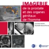 Imagerie de la prostate et des organes génitaux de l'homme