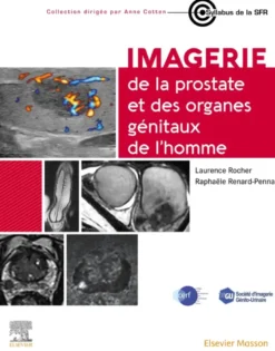 Imagerie de la prostate et des organes génitaux de l'homme