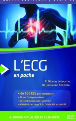 L'Ecg En Poche R2C + De 150 Ecg